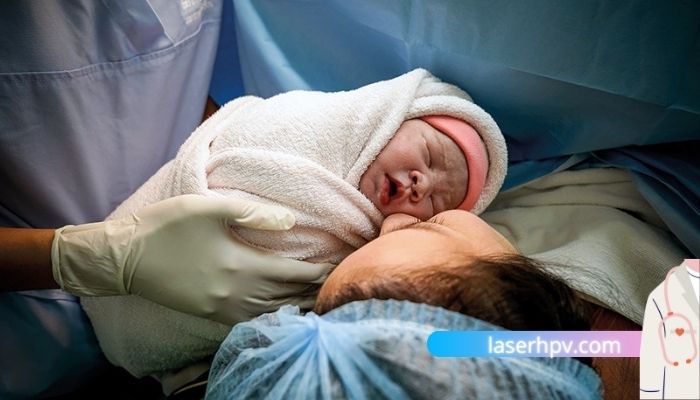 انتقال ویروس اچ پی وی از مادر نوزاد
